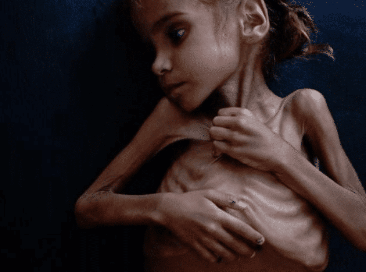 bambina simbolo guerra yemen morta