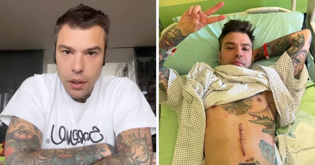 fedez operazione