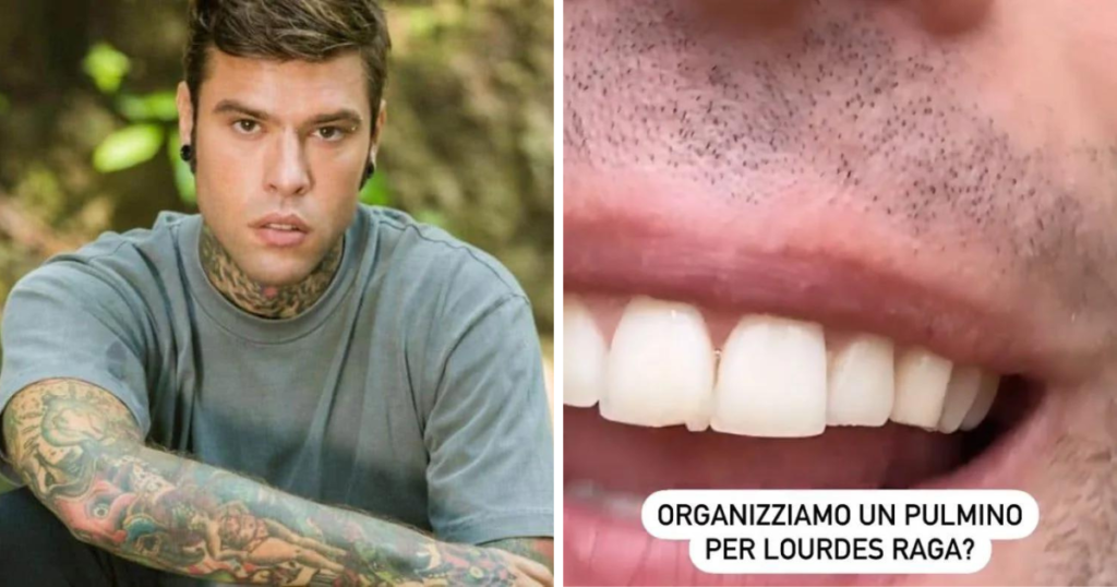 fedez